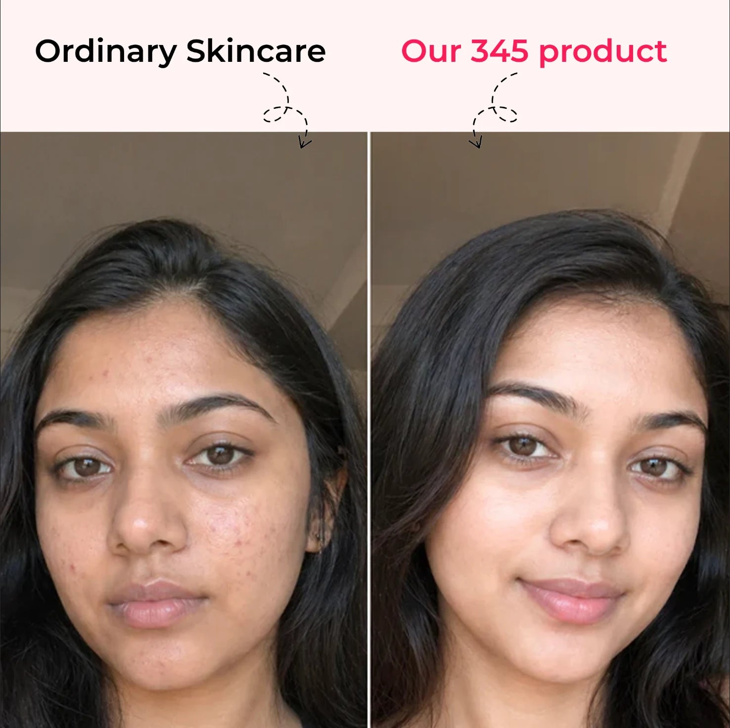 Dr. Althea 345 Relief Cream